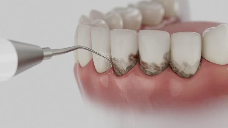 Trusted Tooth Extraction service in Parkersburg, WV - Dentist Open Now